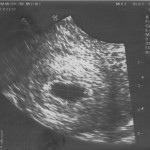 sonogram-01 (1132x842)