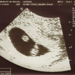 sonogram-02 (1137x844)