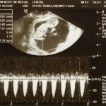 sonogram-03a (1133x849)