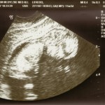 sonogram-03b (1132x850)