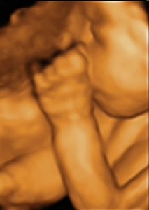 sonogram-04a (330x463)